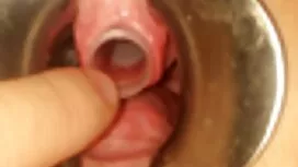 باگیرا آنا فاکس سیاه ...